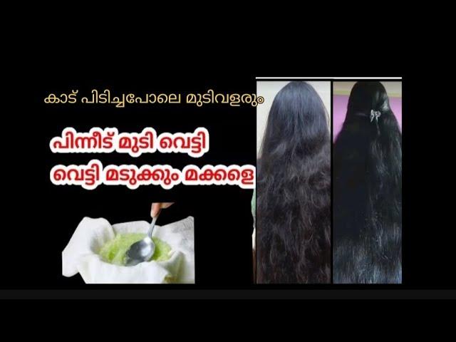 ️for men and women ഇത് മാത്രം മതി മുടിയുടെ പ്രശ്നങ്ങൾ മാറാൻ# hair growth pack #youtube longviedio