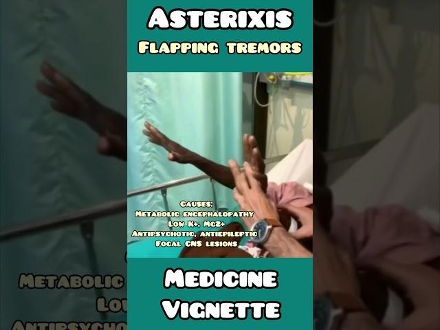 Asterixis : flapping tremors made simple for USMLE, NEET PG, NCLEX #neet #usmle #medical  #doctor