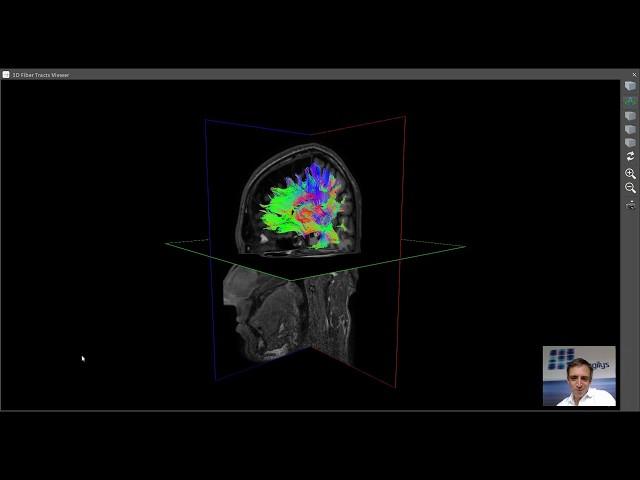 Brain Mysteries - 2. The Brain's Highways