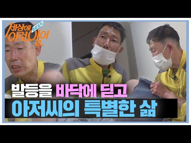 ‘발등’으로 걷는 아저씨의 특별한 삶ㅣ순간포착 세상에 이런 일이(Instant Capture)ㅣSBS Story