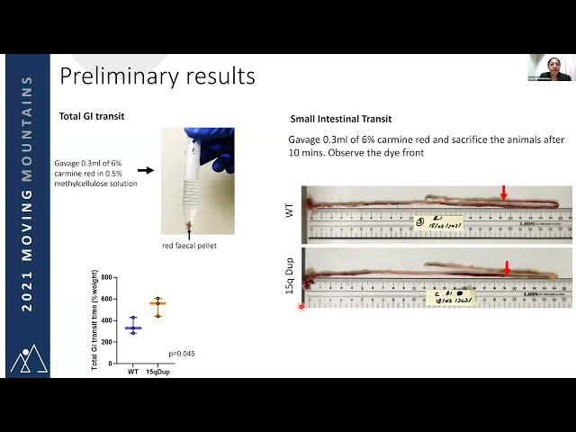 GI Dysfunction in dup15q syndrome