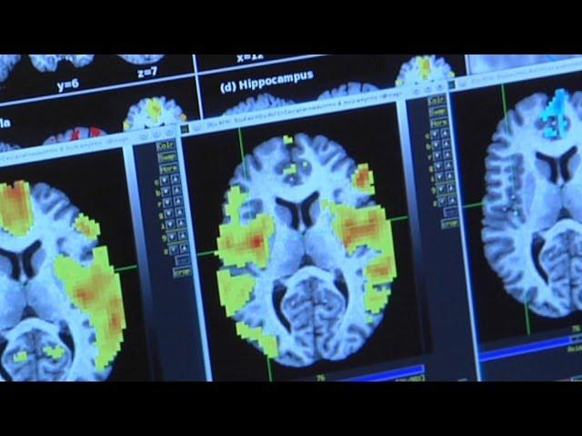 Investigating Drug Use: Brain Imaging