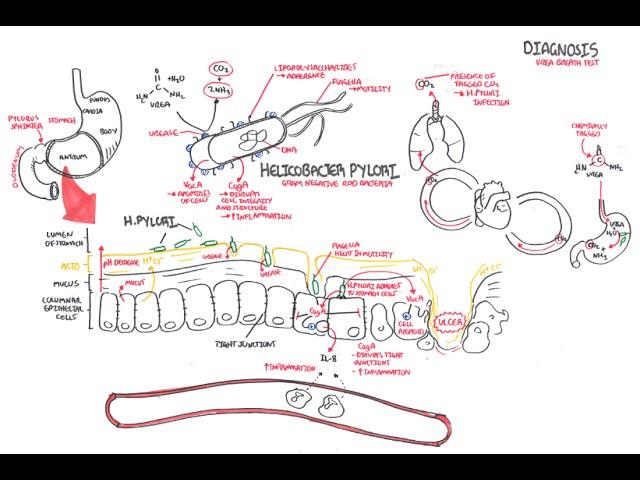 Microbiology - Helicobacter Pylori (Ulcer)