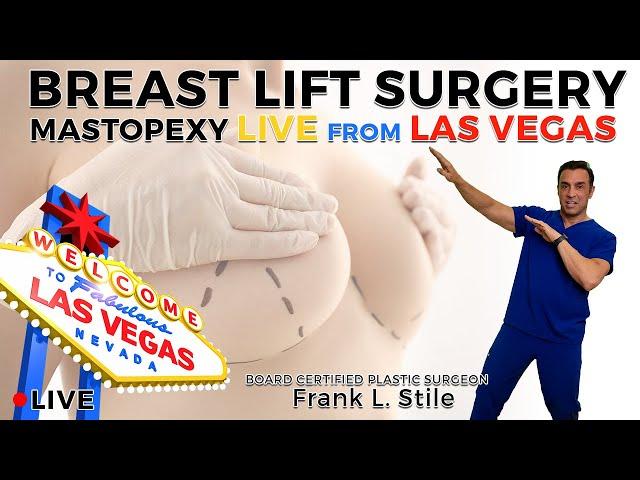 Breast Lift Surgery | Mastopexy Live from Las Vegas Nevada