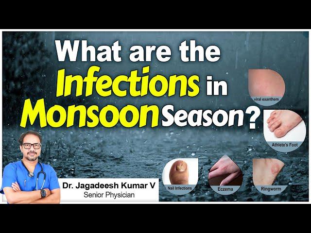 Hi9 | What are the Infections in Monsoon Season | Dr. Jagadeesh Kumar VSenior Physician