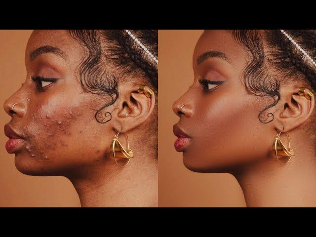 High-End Skin Retouching Beginner Photoshop Tutorial | Frequency Separation