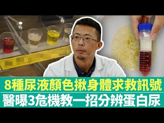 【健康療天室】8種尿液顏色揪身體求救訊號　醫曝3危機教一招分辨蛋白尿｜中時新聞網