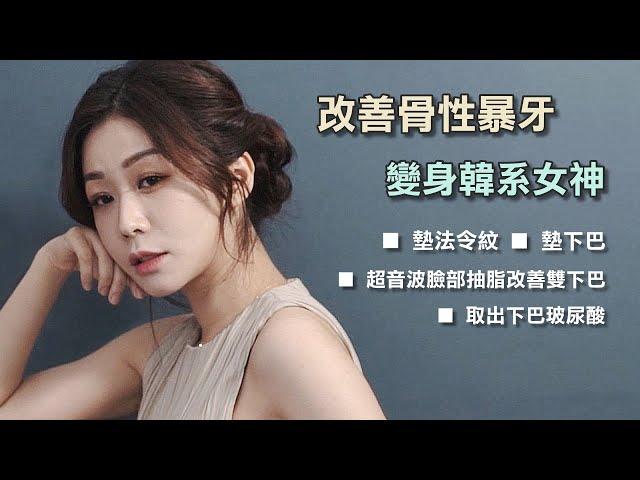 墊法令紋下巴、超音波臉部抽脂改善雙下巴、取出下巴玻尿酸改善暴牙嘴凸困擾，Summer變身高顏質韓系女神心得日記分享