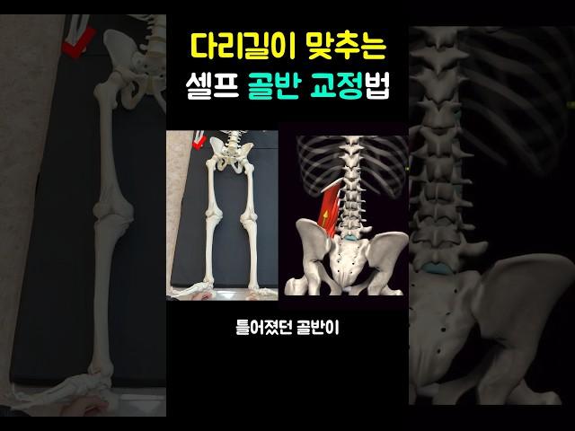 다리길이 맞춰지는 셀프 골반 교정법