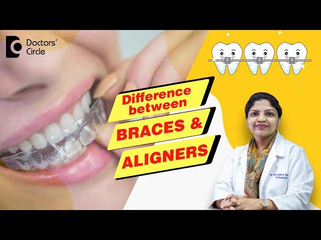 Aligners vs Braces Treatment - Which is the Best? - Dr. Divyashree Rajendra | Doctors' Circle