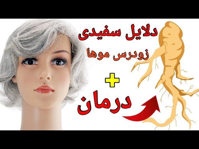 دلایل سفیدی زودرس موها چیست + راه های  درمان