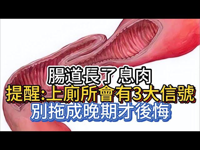 腸道長了息肉，提醒：上廁所會有3大信號，別拖成晚期才後悔