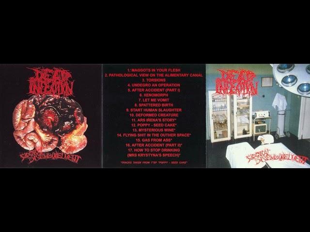 Dead Infection – Surgical Disembowelment