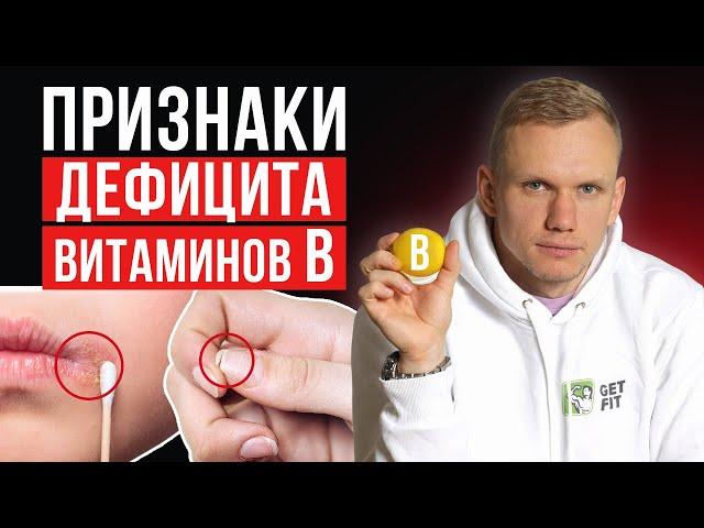 Симптомы и признаки нехватки витаминов группы B! / Как проявляется дефицит витаминов Б?