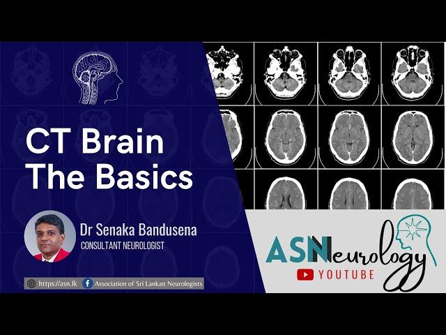 Neurology Basics - CT Brain by Dr Senaka Bandusena