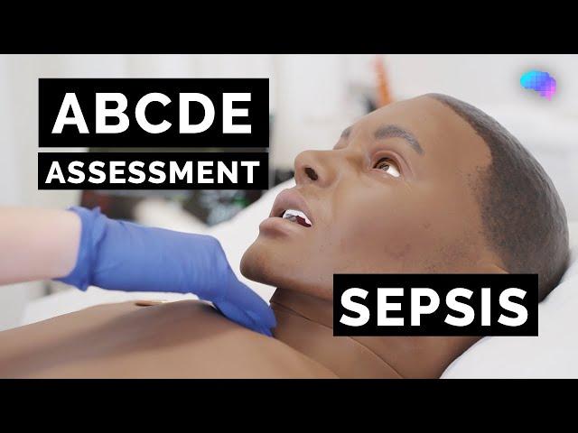 ABCDE Assessment | Sepsis | Emergency Simulation Scenario | OSCE Guide | UKMLA | CPSA | PLAB 2