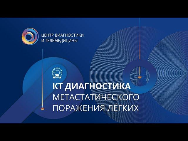 КТ диагностика метастатического поражения лёгких