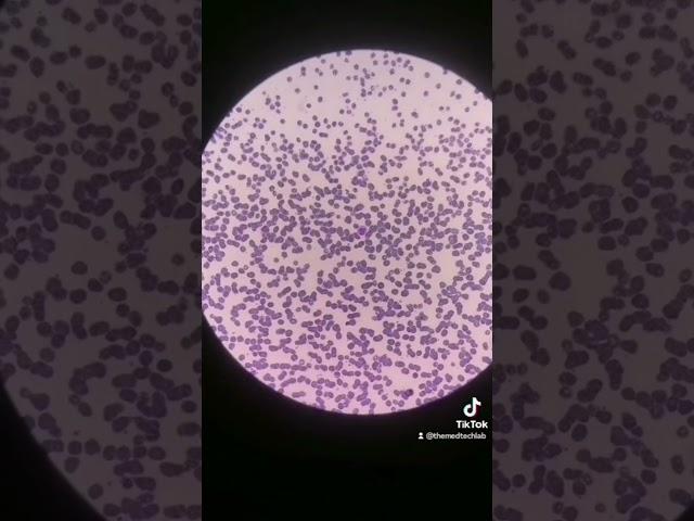 Did you notice what's wrong with the video? #medtech #laboratory #medtechstudent #medtechknows #cls