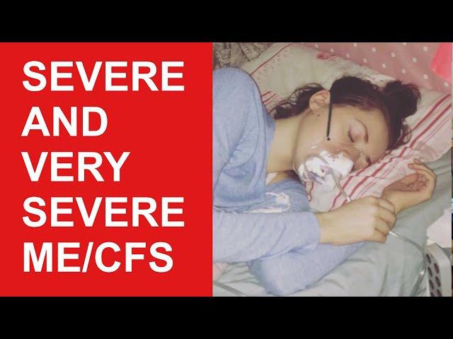 Severe and Very Severe ME/CFS (Myalgic Encephalomyelitis/Chronic Fatigue Syndrome)