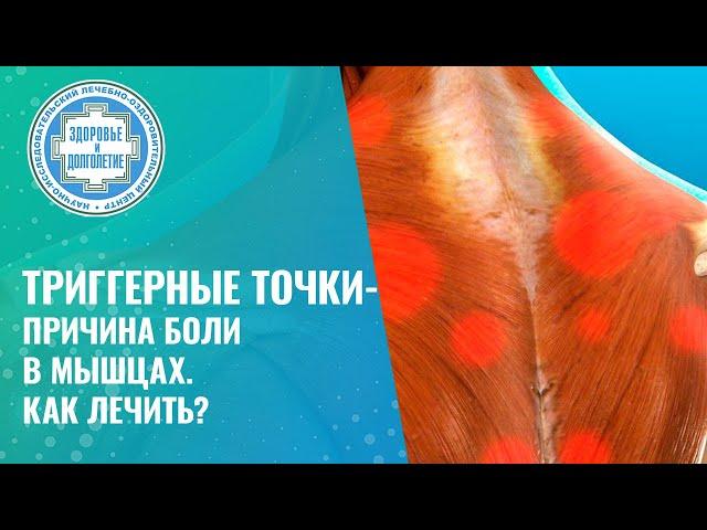   ТРИГГЕРНЫЕ ТОЧКИ - почему возникает боль и мышечное напряжение? Как лечить?