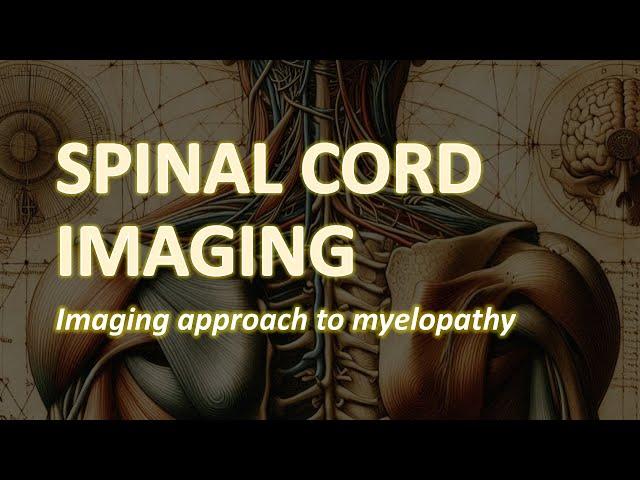 Spinal Cord Imaging: Imaging approach to Myelopathy