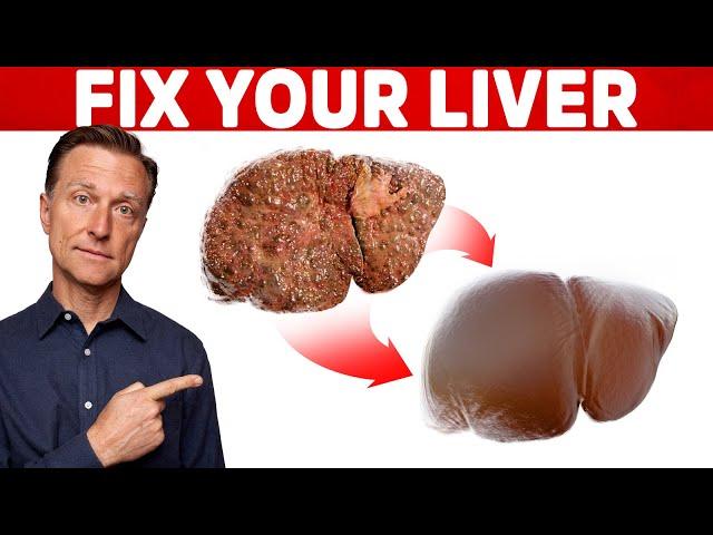 The 6 Best Ways to Heal a Fatty Liver