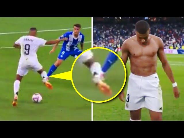 Mbappe Injury against Alaves 