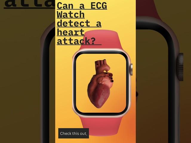 ECG Watch…Detect Heart Attack?