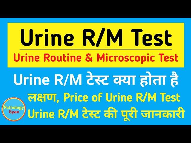 Urine R/M test in hindi | Urine routine & microscopic test | Urine Examination | Urine Analysis Test