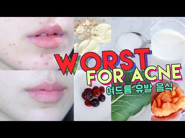 WORST FOODS FOR ACNE! • Get Rid of Hormonal Acne Naturally  Liah Yoo