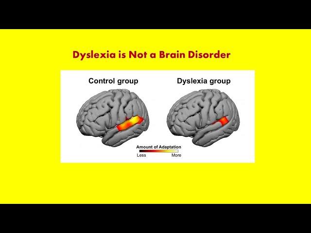 Dyslexia: Some Background Information, Andrew P. Johnson, Ph.D.