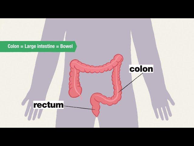 What is a colonoscopy and why do I need one?