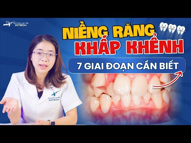 7 Giai Đoạn Niềng Răng Khấp Khểnh Phải Biết Trước Khi Chỉnh Nha