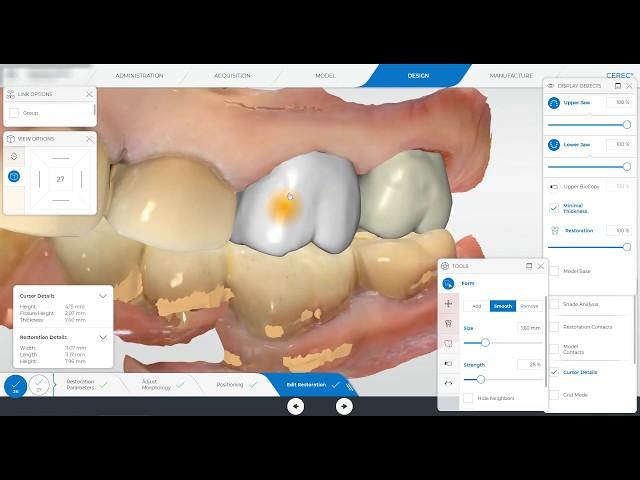 Cerec Primescan Design of Adjacent Crowns