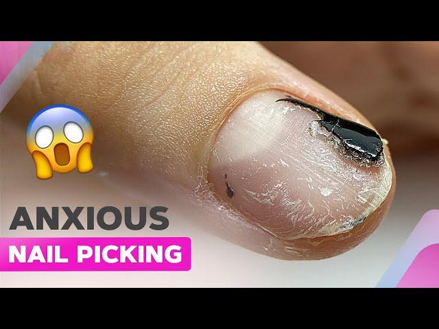 Transforming Damaged Nails | Iridescent Chrome Powder Nails