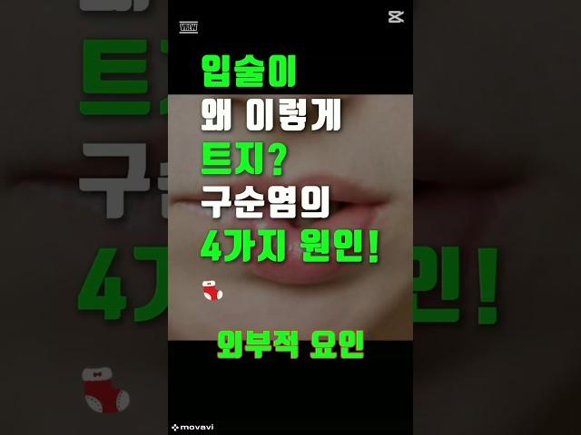 입술이 왜 이렇게 트지? 구순염의 4가지 원인! #건강120세 #건강120세까지 #건강 #건강정보 #구순염