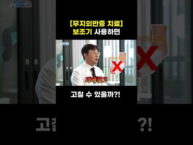 [무지외반증 치료] 보조기 사용하면 고칠 수 있을까?!