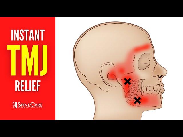 How to Relieve TMJ Pain at Home | 30 SECOND RELIEF