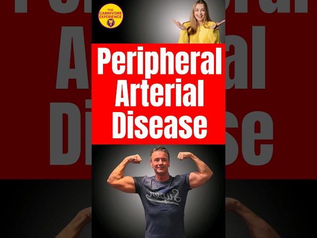 Improve the symptoms of Peripheral Arterial Disease with carnivore. #pad #arteryhealth