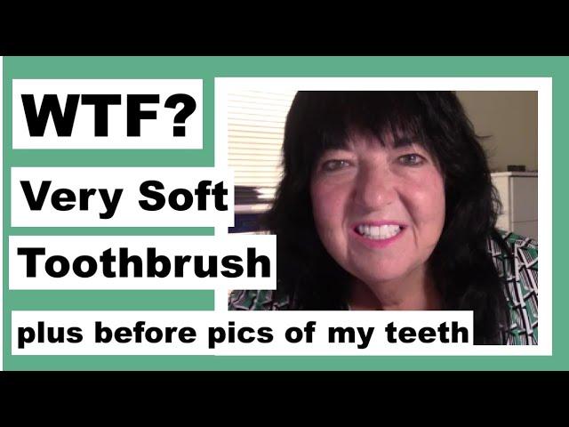 My Very Soft Toothbrush plus Before Pics of My Teeth