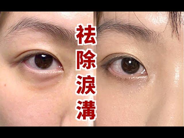 0成本按摩去淚溝眼袋 | 不醫美！告別遮瑕 日本爆火去淚溝按摩法來了