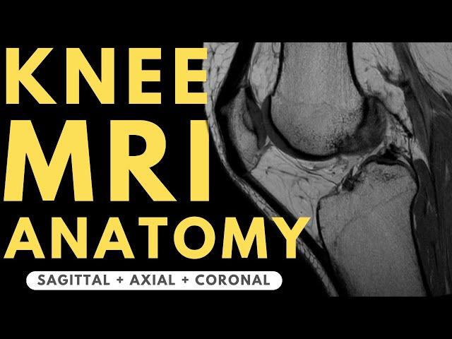 Knee MRI Anatomy | Radiology anatomy part 1 prep | How to interpret a knee MRI