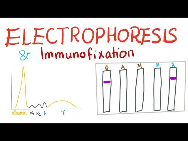 Electrophoresis, Immunoelectrophoresis and Immunofixation