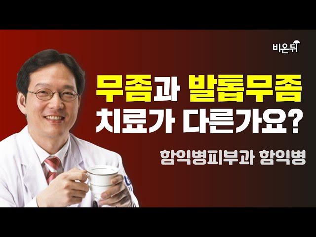 무좀과 발톱무좀 치료는 다른가요? (함익병피부과 함익병)