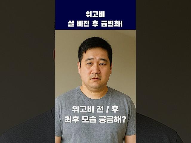 위고비 살 빠진 후 급변화! #shorts #위고비 #부작용