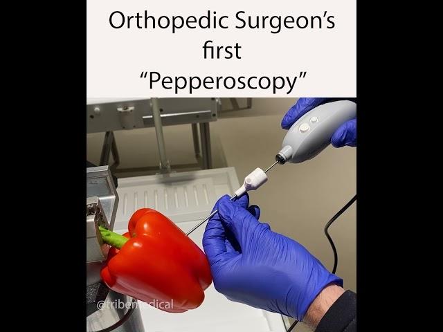 Orthopedic Surgeon’s first “pepperoscopy”