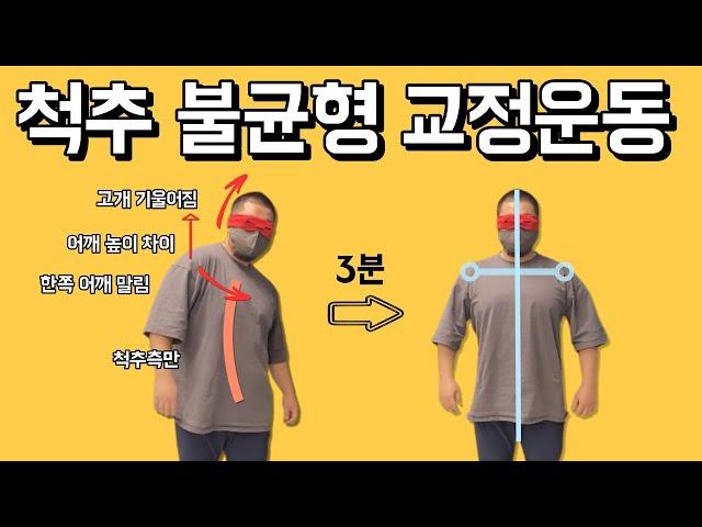 척추측만 + 어깨높이 + 고개기울어짐 + 한쪽라운드숄더  교정운동