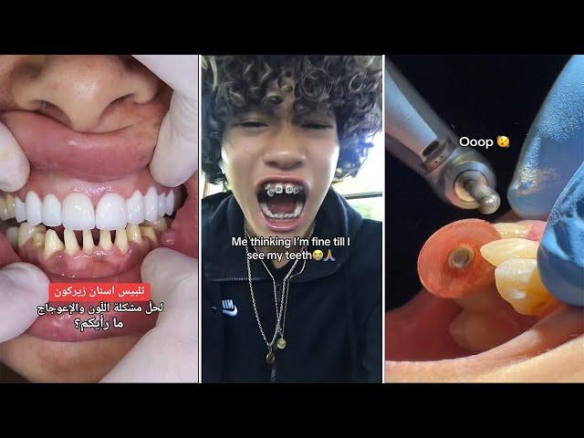 Dental Tiktoks That Will Make You Run To The Dentist