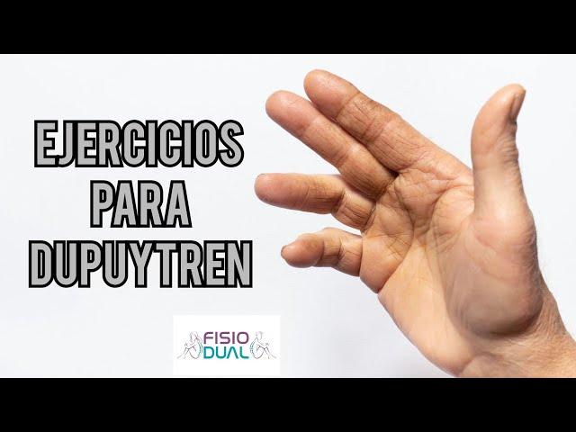 Ejercicios para DUPUYTREN