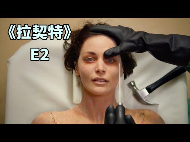 【蛋挞】那些被切除大脑的人，后来怎么样了？《拉契特》第二集